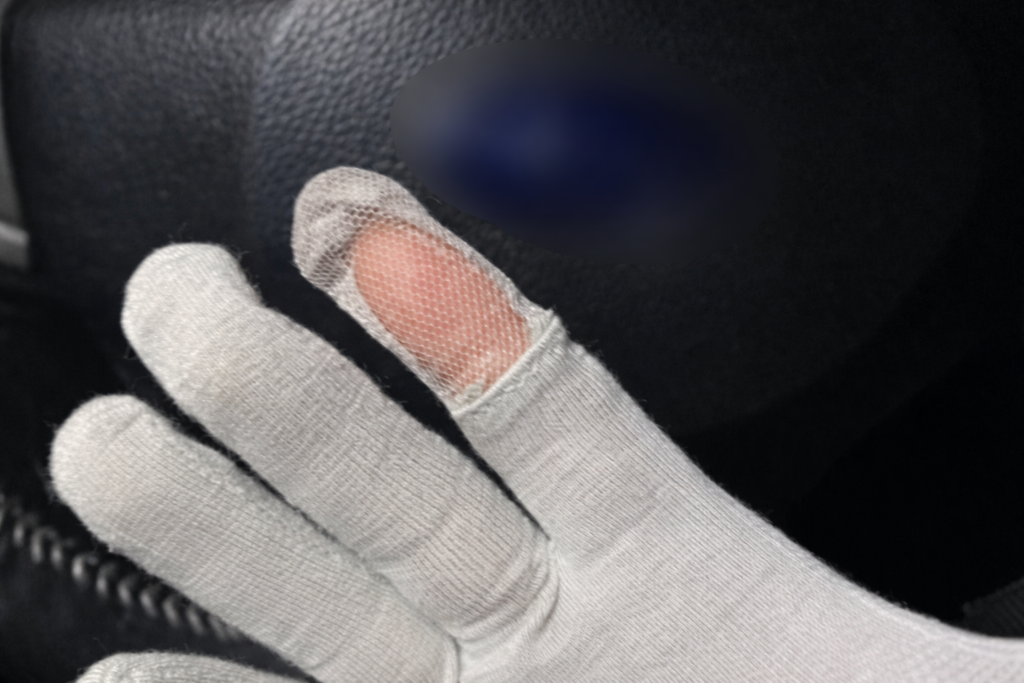 白いメッシュ素材の手袋をはめた手のアップ。中指の先端部分が破れており、内側の指先の肌が見えている。背景は黒いレザー調の素材。